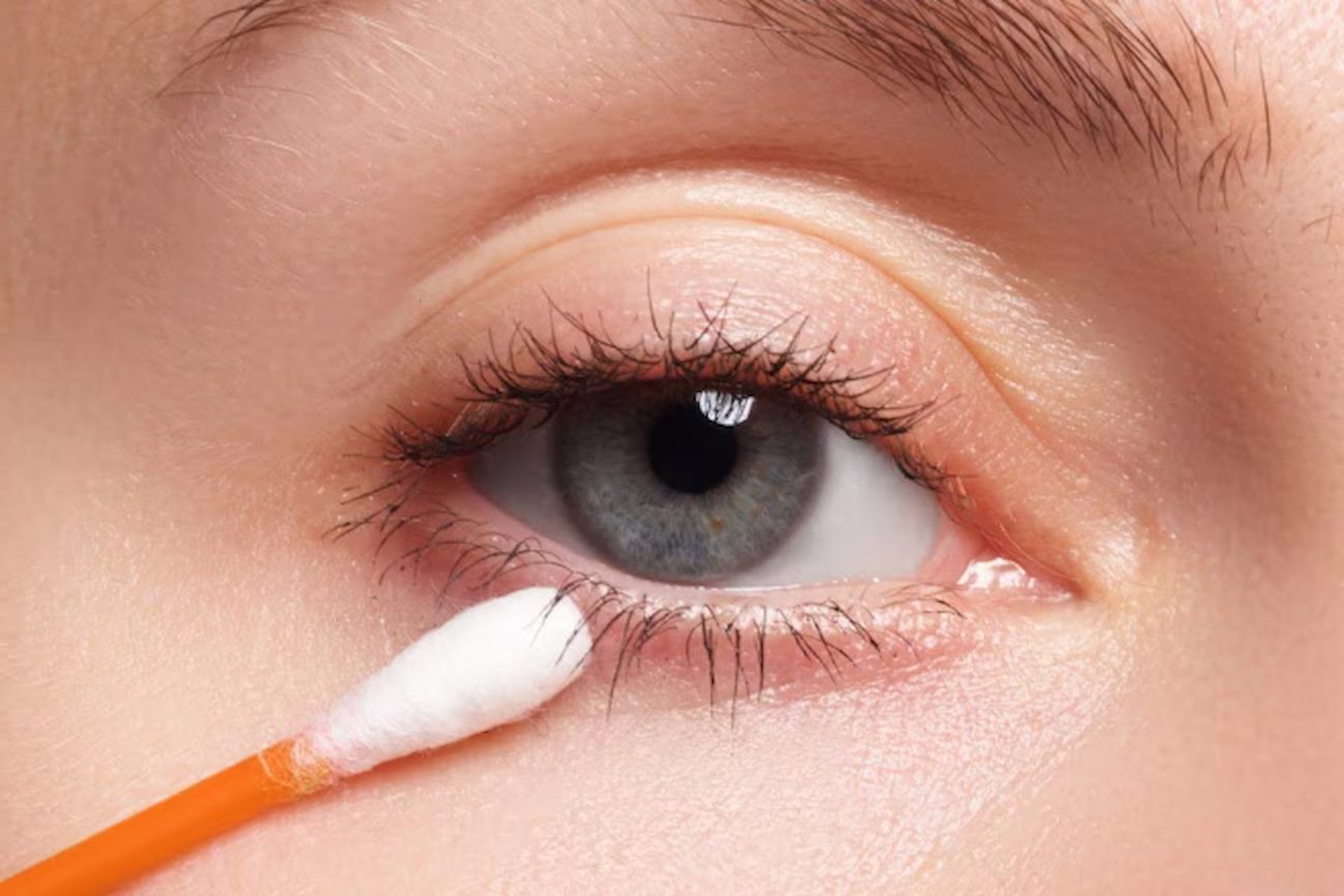 Мазок з очей при блефарити